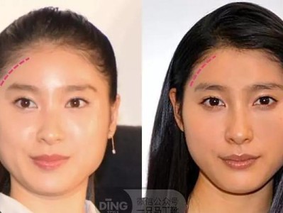 探讨何为“大脸”的标准（以面部特征为切入点，解析大脸的定义与影响因素）